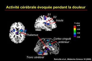 Activité cérébrale évoquée pendant la douleur
Thalamus
S1
S2
Insula
Cortex cingulé
antérieur
Rainville et al., Médecine Science 16 (2000)
Tronc cérébral
 