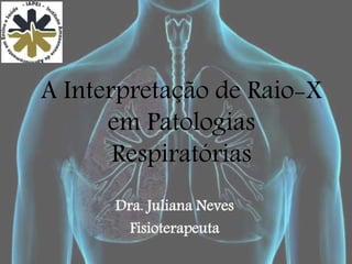 A Interpretação de Raio-X
em Patologias
Respiratórias
Dra. Juliana Neves
Fisioterapeuta
 