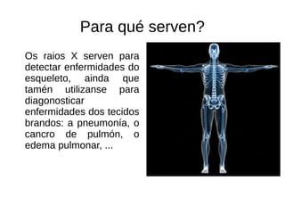 Para qué serven?
Os raios X serven para
detectar enfermidades do
esqueleto, ainda que
tamén utilizanse para
diagonosticar
...