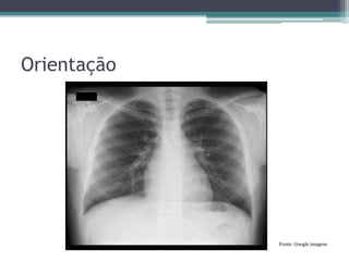 Orientação
Fonte: Google imagem
 