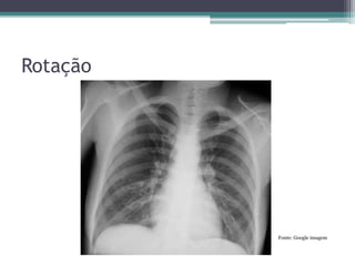 Rotação
Fonte: Google imagem
 