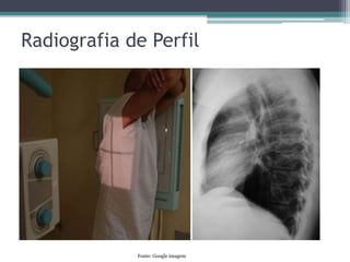 Radiografia de Perfil
Fonte: Google imagem
 