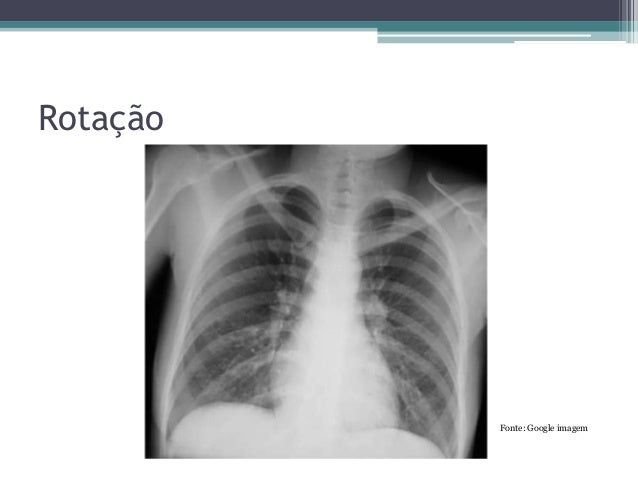 Curso de raio x