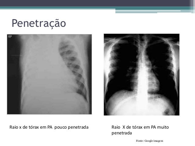 Curso de raio x