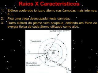 Raios X Característicos Elétron acelerado ioniza o átomo nas camadas mais internas: K, L. Fica uma vaga desocupada nesta camada; Outro elétron do átomo vem ocupá-la, emitindo um fóton de evergia típica de cada átomo utilizado como alvo. Prof. Rodrigo Penna 