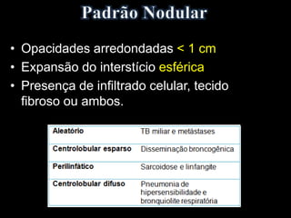 • Opacidades arredondadas < 1 cm
• Expansão do interstício esférica
• Presença de infiltrado celular, tecido
fibroso ou ambos.
 
