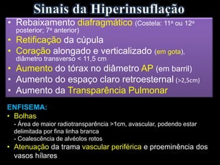 • Rebaixamento diafragmático (Costela: 11a ou 12a
posterior; 7a anterior)
• Retificação da cúpula
• Coração alongado e verticalizado (em gota),
diâmetro transverso < 11,5 cm
• Aumento do tórax no diâmetro AP (em barril)
• Aumento do espaço claro retroesternal (>2,5cm)
• Aumento da Transparência Pulmonar
ENFISEMA:
• Bolhas
- Área de maior radiotransparência >1cm, avascular, podendo estar
delimitada por fina linha branca
- Coalescência de alvéolos rotos
• Atenuação da trama vascular periférica e proeminência dos
vasos hílares
 