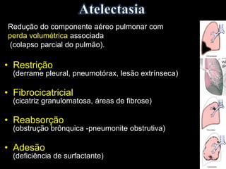 Redução do componente aéreo pulmonar com
perda volumétrica associada
(colapso parcial do pulmão).
• Restrição
(derrame pleural, pneumotórax, lesão extrínseca)
• Fibrocicatricial
(cicatriz granulomatosa, áreas de fibrose)
• Reabsorção
(obstrução brônquica -pneumonite obstrutiva)
• Adesão
(deficiência de surfactante)
 