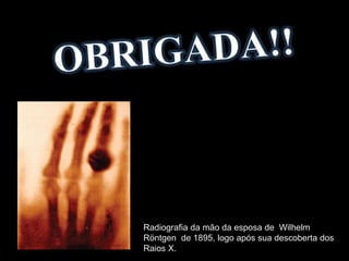 Radiografia da mão da esposa de Wilhelm
Röntgen de 1895, logo após sua descoberta dos
Raios X.
 