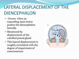 LATERAL DISPLACEMENT OF THE
DIENCEPHALON
 Occurs when an
expanding mass lesion
pushes the diencephalon
laterally.
 Monitored by
displacement of the
calcified pineal gland
 This lateral displacement is
roughly correlated with the
degree of impairment of
consciousness
 