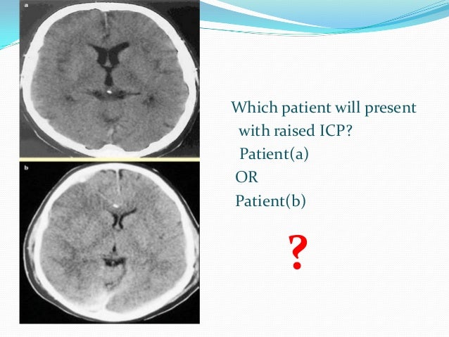 Raised Intracranial Pressure Raised Intracranial Pressure