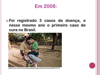 Em 2008:
 Foi registrado 3 casos da doença, e
nesse mesmo ano o primeiro caso de
cura no Brasil.
www.ne10.uol.com.br/canal/cotidiano/pernambuco/notícia/2009/10/16.
 