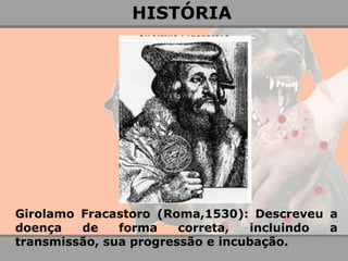 Girolamo Fracastoro (Roma,1530): Descreveu a doença de forma correta, incluindo a transmissão, sua progressão e incubação. 
HISTÓRIA  