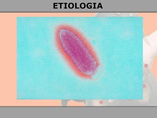 ETIOLOGIA 
 