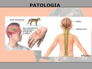PATOLOGIA 
 