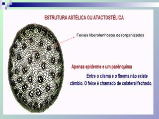 Feixes liberolenhosos desorganizados
 