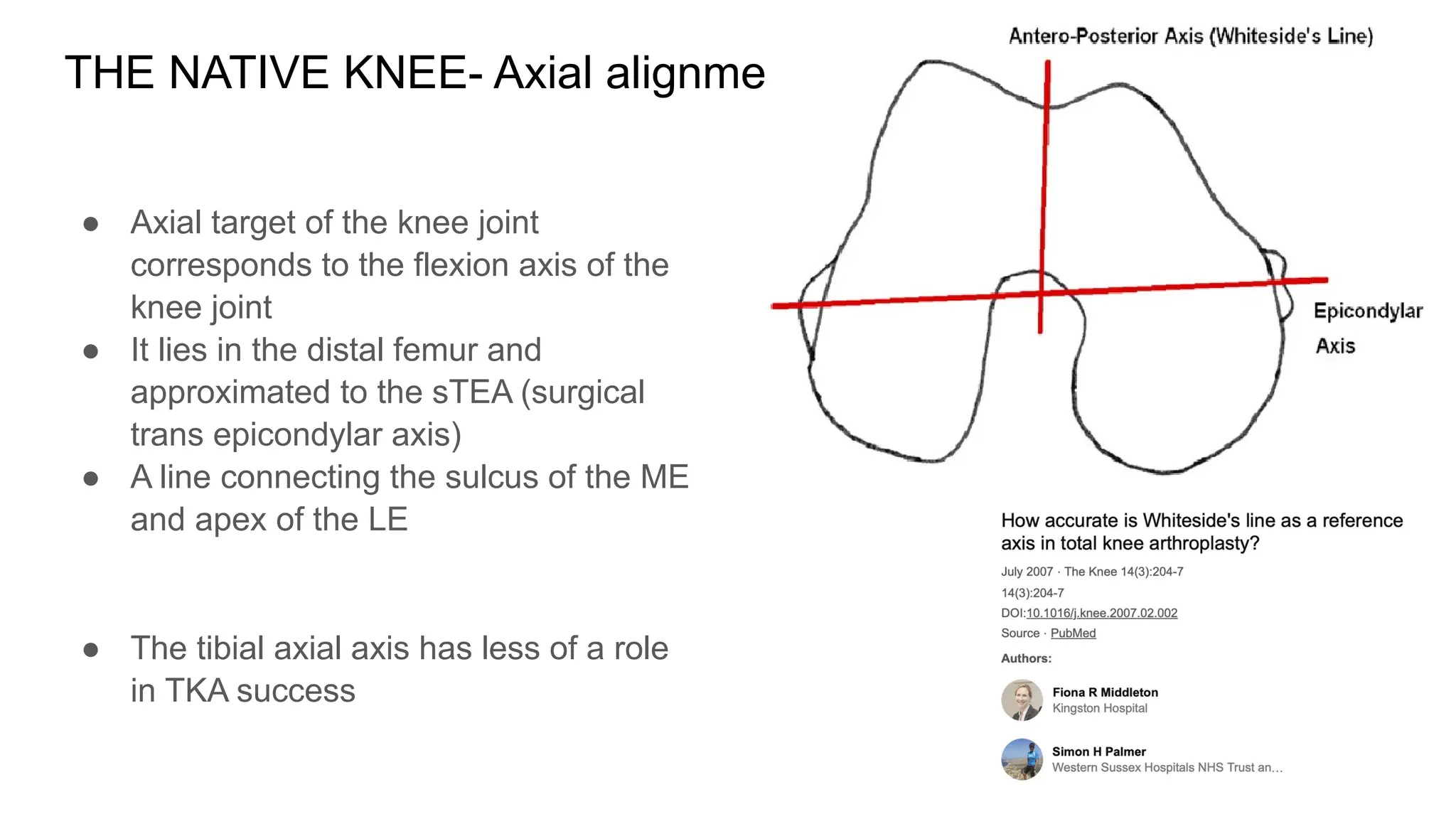 Rajagiri Alignment in Total Knee Arthroplasty.pptx