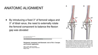 Rajagiri Alignment in Total Knee Arthroplasty.pptx
