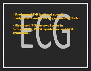 = Prolonged P-R interval scen in
bradycardia and first degree heart block.
= Shortend P-R interval seen in
tachycardia, WPW syndrome and LGL
syndrome.
 