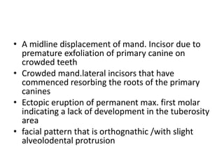 • A midline displacement of mand. Incisor due to
premature exfoliation of primary canine on
crowded teeth
• Crowded mand.lateral incisors that have
commenced resorbing the roots of the primary
canines
• Ectopic eruption of permanent max. first molar
indicating a lack of development in the tuberosity
area
• facial pattern that is orthognathic /with slight
alveolodental protrusion
 