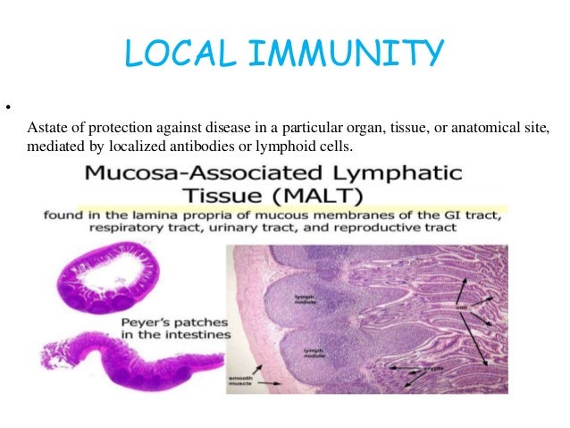 local immunity Lymphoid tissue associated with mucous ...