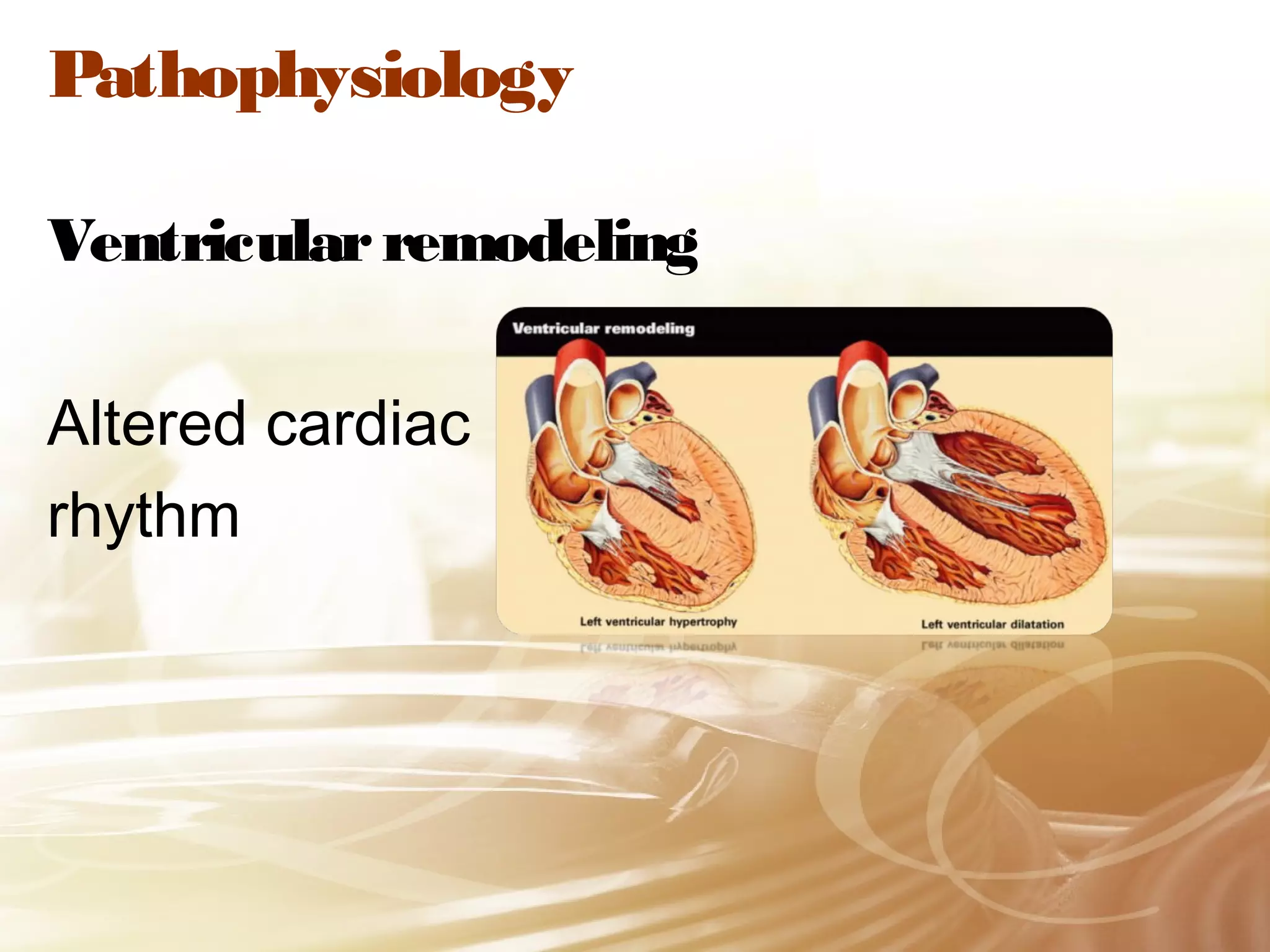 Pathophysiology
Ventricular remodeling
Altered cardiac
rhythm

 