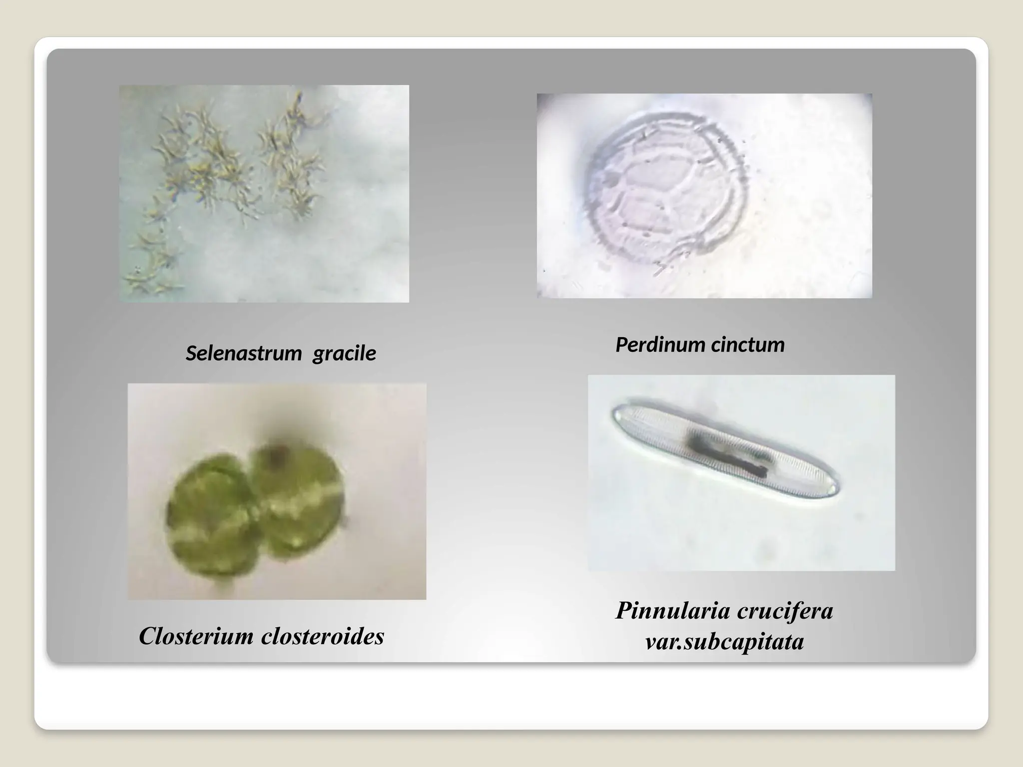 Selenastrum gracile Perdinum cinctum
Closterium closteroides
Pinnularia crucifera
var.subcapitata
 