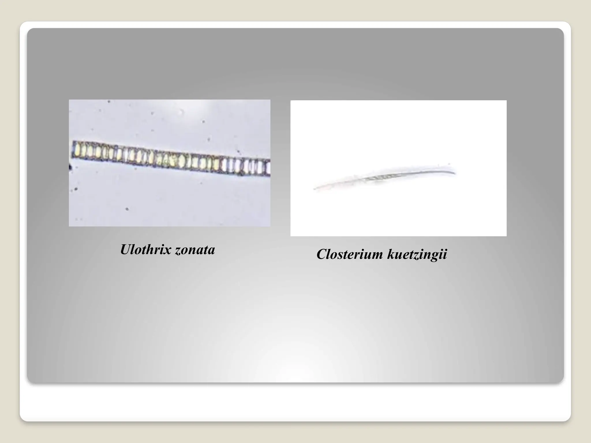 Closterium kuetzingii
Ulothrix zonata
 