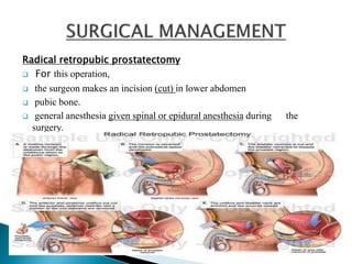 Radical retropubic prostatectomy
 For this operation,
 the surgeon makes an incision (cut) in lower abdomen
 pubic bone.
 general anesthesia given spinal or epidural anesthesia during the
surgery.
 