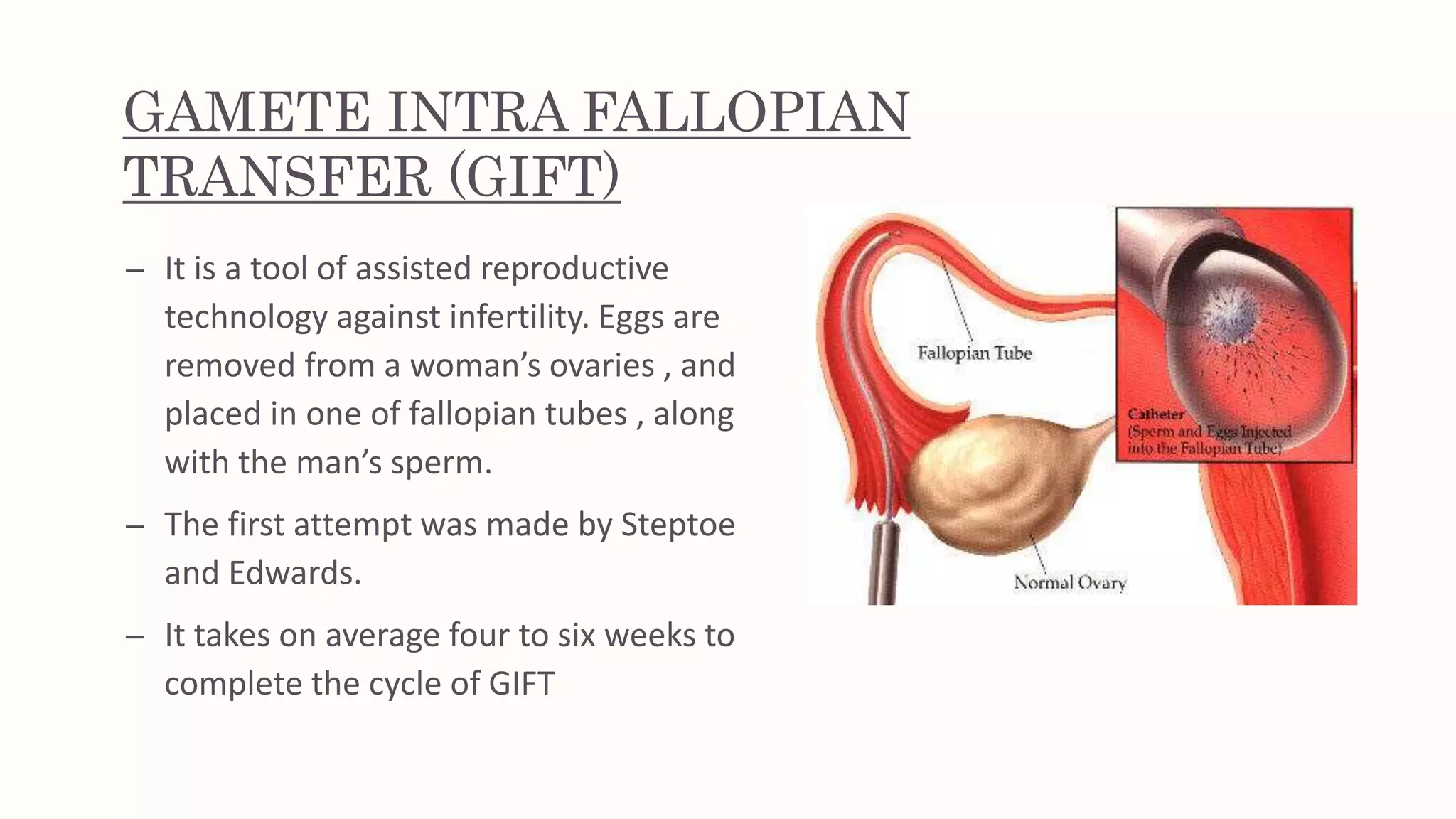 assisted reproductive technology | PPTX