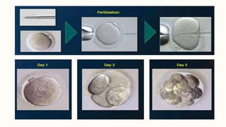 assisted reproductive technology | PPTX