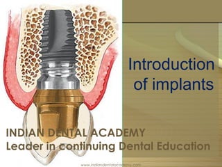 Introduction
of implants
INDIAN DENTAL ACADEMY
Leader in continuing Dental Education
www.indiandentalacademy.com
 