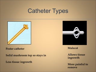 Catheter Types
Pester catheter
Solid mushroom top so stays in
Less tissue ingrowth
Malecot
Allows tissue
ingrowth
More painful to
remove
 