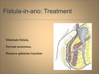 Fistula-in-ano: Treatment
Eliminate fistula,
Prevent recurrence,
Preserve sphincter function
 