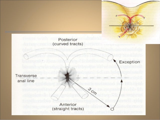 Rakesh benign-anorectal-