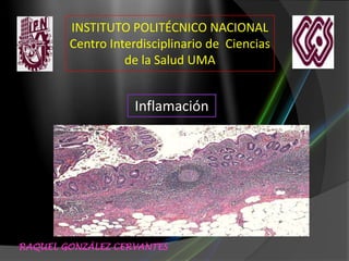 INSTITUTO POLITÉCNICO NACIONAL
Centro Interdisciplinario de Ciencias
de la Salud UMA

Inflamación

RAQUEL GONZÁLEZ CERVANTES

 
