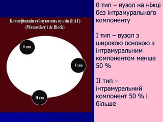 0 тип – вузол на ніжці без інтрамурального компоненту I  тип – вузол з широкою основою з інтрамуральним компонентом менше 50 % II  тип – інтрамуральний компонент 50 % і більше 