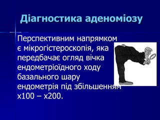 Діагностика аденоміозу Перспективним напрямком є мікрогістероскопія, яка передбачає огляд вічка ендометріоїдного ходу базального шару ендометрія під збільшенням х100 – х200.  
