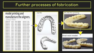 Further processes of fabrication
Step files
 