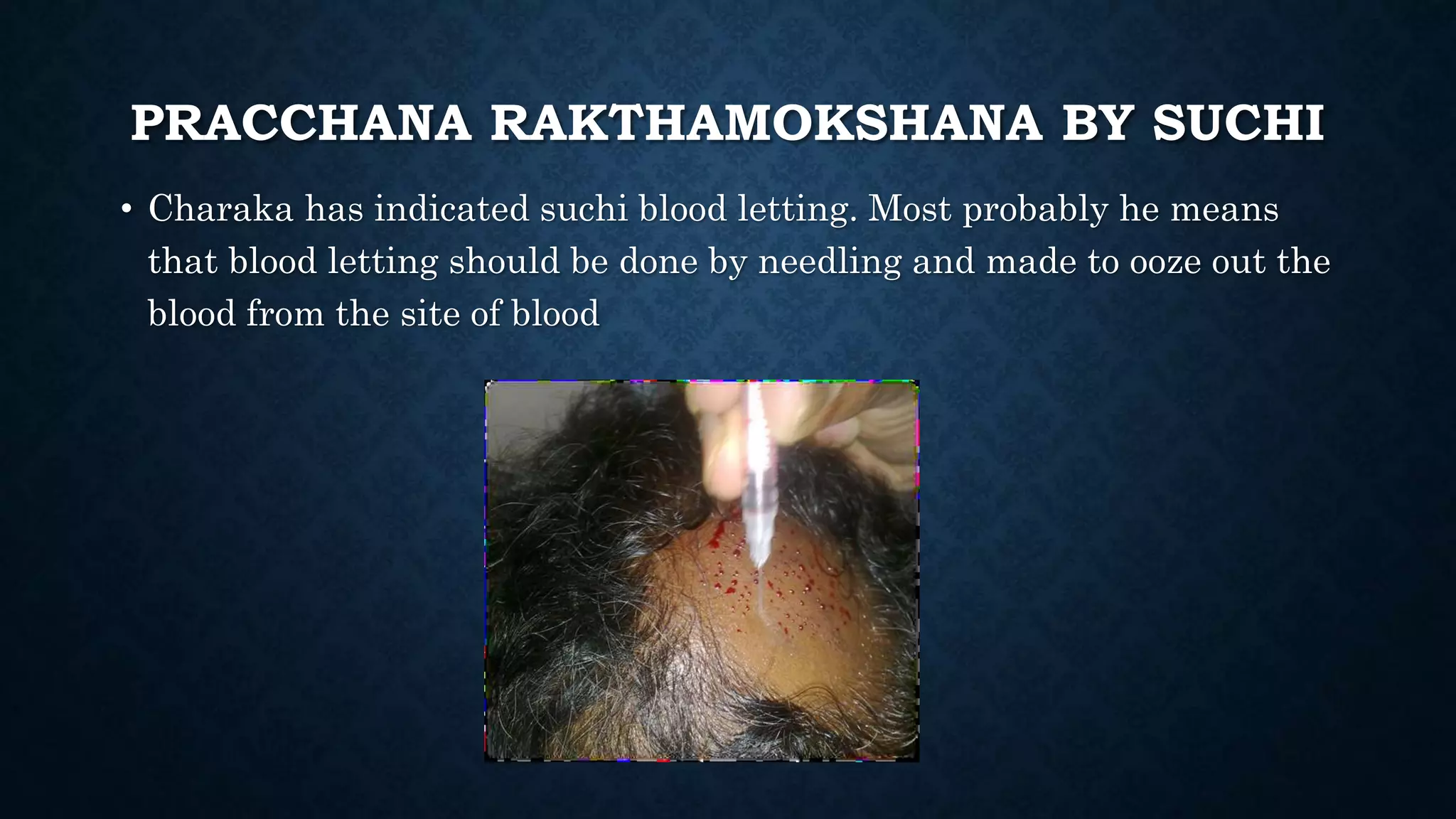 Concept of Rakta Mokshana | PPTX