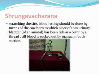 Shrungavacharana
 scratching the site, blood letting should be done by
means of the cow horn to which piece of thin urinary
bladder (of an animal) has been tide as a cover by a
thread , till blood is sucked out by manual mouth
suction.
 
