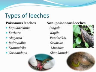 Types of leeches
Poisonous leeches Non- poisonous leeches
 KapilaKrishna Pingala
 Karbura Kapila
 Alagarda Pundarikhi
 Indrayudha Savarika
 Saamudrika Mushika
 Gochandana Shankamuki
 