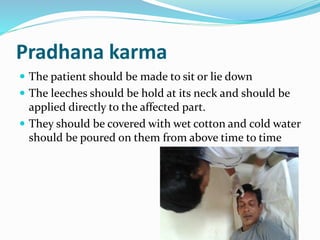 Pradhana karma
 The patient should be made to sit or lie down
 The leeches should be hold at its neck and should be
applied directly to the affected part.
 They should be covered with wet cotton and cold water
should be poured on them from above time to time
 
