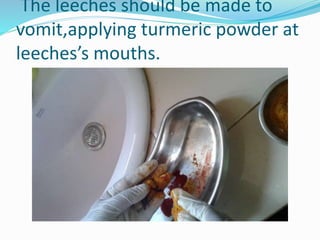 The leeches should be made to
vomit,applying turmeric powder at
leeches’s mouths.
 