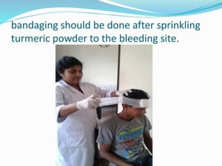 bandaging should be done after sprinkling
turmeric powder to the bleeding site.
 