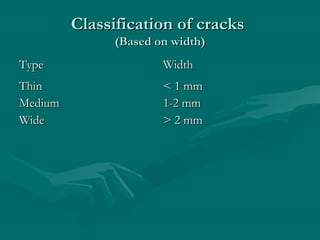 Classification of cracksClassification of cracks
(Based on width)(Based on width)
TypeType WidthWidth
ThinThin
MediumMedium
WideWide
< 1 mm< 1 mm
1-2 mm1-2 mm
> 2 mm> 2 mm
 