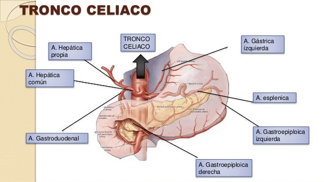 Tronco Celiaco | www.picswe.net