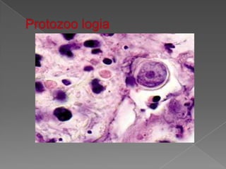Protozoo logia