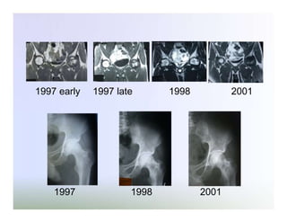 1997 early

1997

1997 late

1998

1998

2001

2001

 