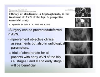 Surgery can be prevented/deferred
in AVN.
•

•

•

Improvement objective clinical
assessments but also in radiological
parameters.
a trial of alendronate for all
patients with early AVN of the hip,
i.e. stages I and II and early stage III
will be beneficial.

 